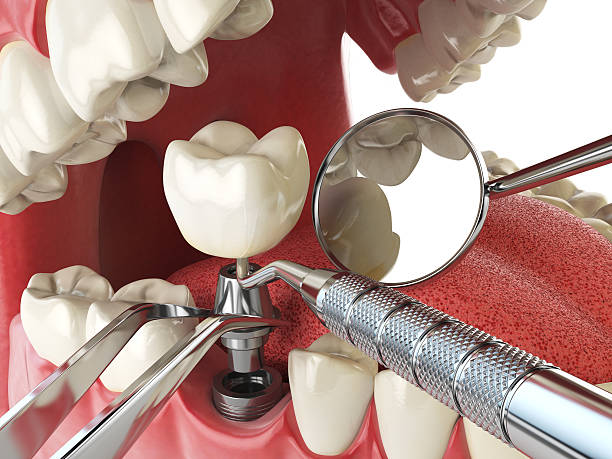 Best Pediatric Emergency Dentist in Tri Lakes, IN